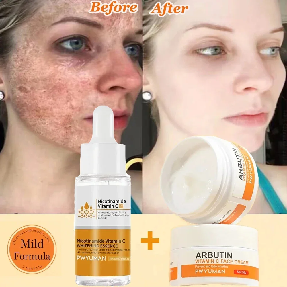 Dark Spots Remover Whitening Face Set Freckle Melanin Correcting Reduce Fine Lines Brighten Essence Korean Beauty Skin Care