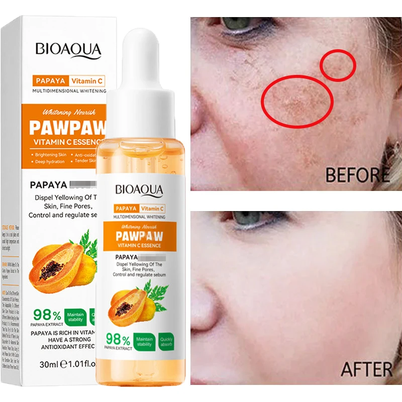 30ml Papaya Freckle Whitening Serum Vitamin C Dark Spots Removal Pigment Melanin Correcting Facial Serum Anti-wrinkle Skin Care whitening freckle face serum effective removal melasma dark spots lighten melanin brighten moisturizing smooth beauty skin care