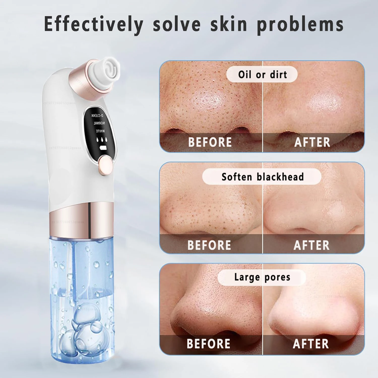 Blackhead Remover Pore Vacuum Face Cleaner Water Cycle Electric Pimple Acne Black Head Removal Rechargeable Black Dot Remover 5