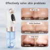 Blackhead Remover Pore Vacuum Face Cleaner Water Cycle Electric Pimple Acne Black Head Removal Rechargeable Black Dot Remover 5