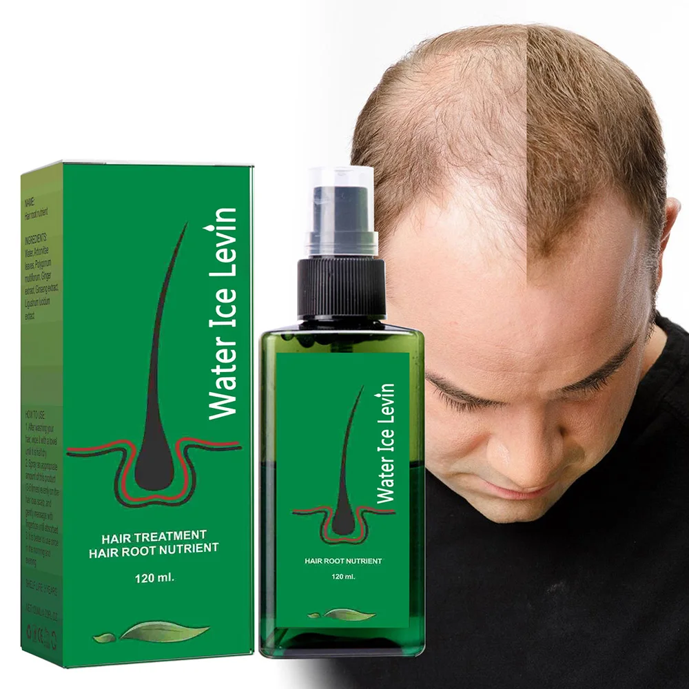Hair Growth Spray Effective Nourishing Root Hair Thick Growth Liquid Anti Loss Ginger Anti-Fall Scalp Massage Care Spray