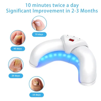 Dispositivo per il trattamento laser dei funghi delle unghie LED UV Trattamento dei funghi delle unghie Terapia dell'onicomicosi Rimuove efficacemente l'affissione del tempo