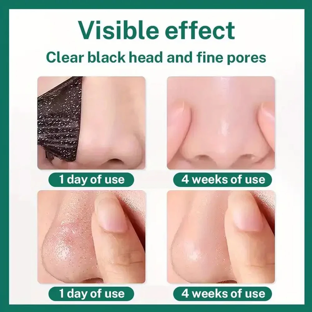 Unisex Deep Cleansing Nose Strips for Acne & Blackhead Removal Shrink Pore Nose Black Head Stickers Skin Care Patch 4