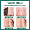 Unisex Deep Cleansing Nose Strips for Acne & Blackhead Removal Shrink Pore Nose Black Head Stickers Skin Care Patch 4