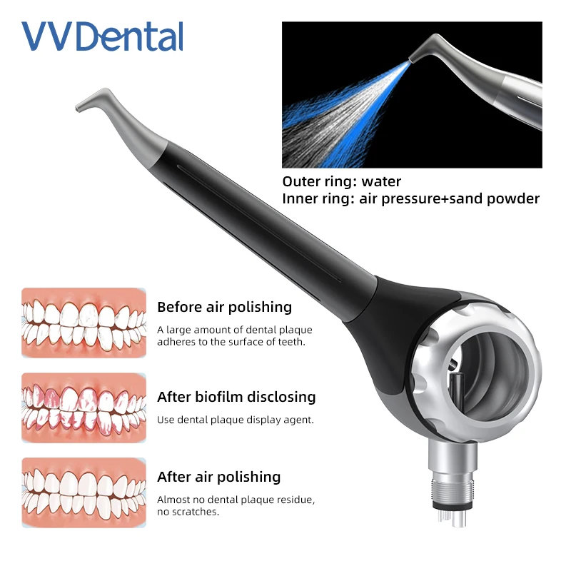 

NEW VV Dental Sandblasting Gun Air Polishing Teeth for Clinic Intraoral Air Prophy Unit System Jet Anti Suction Oral Polisher