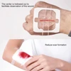 Zipper Band-aid Painless Wound Closure Device Suture-free Wound Dressing Patches Zip Suture Reducer Band Aid 5
