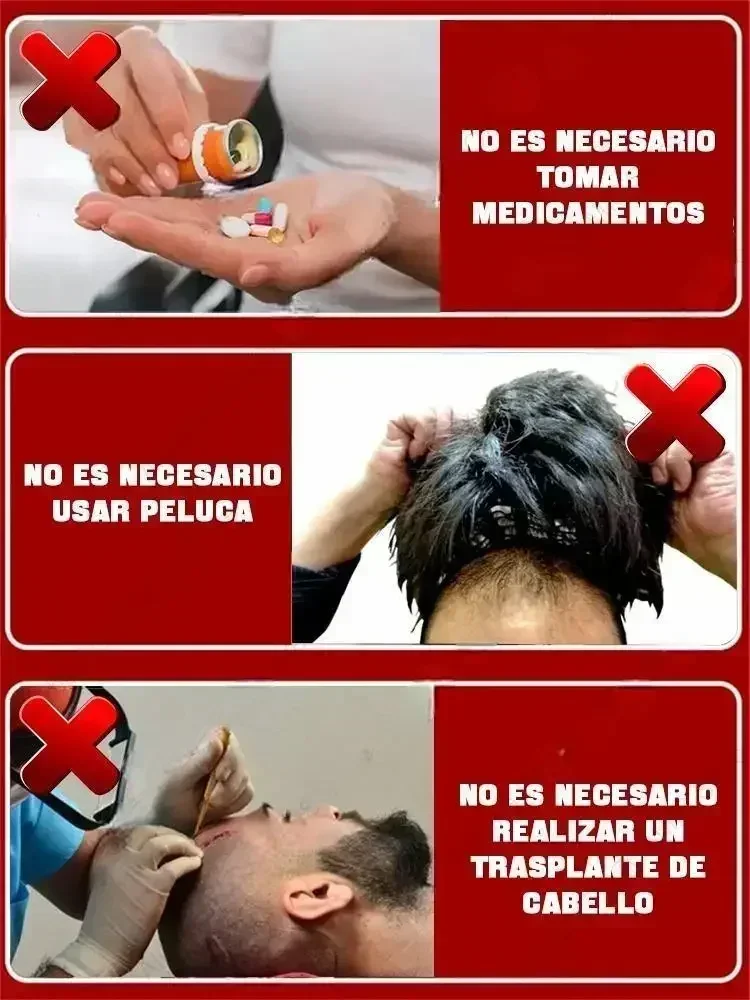 Hair Treatment Hot selling product, 99% of buyers buy again, have more and more hair, say goodbye to baldness, thick hair