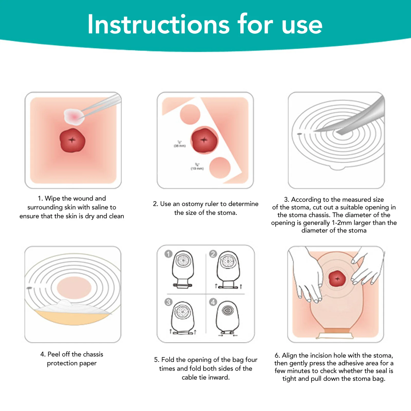 10Pcs Colostomy Bags Disposable Adhesive One Piece Drainable Ostomy Pouch Supplies for Ileostomy One Piece Colostomy Bags 4