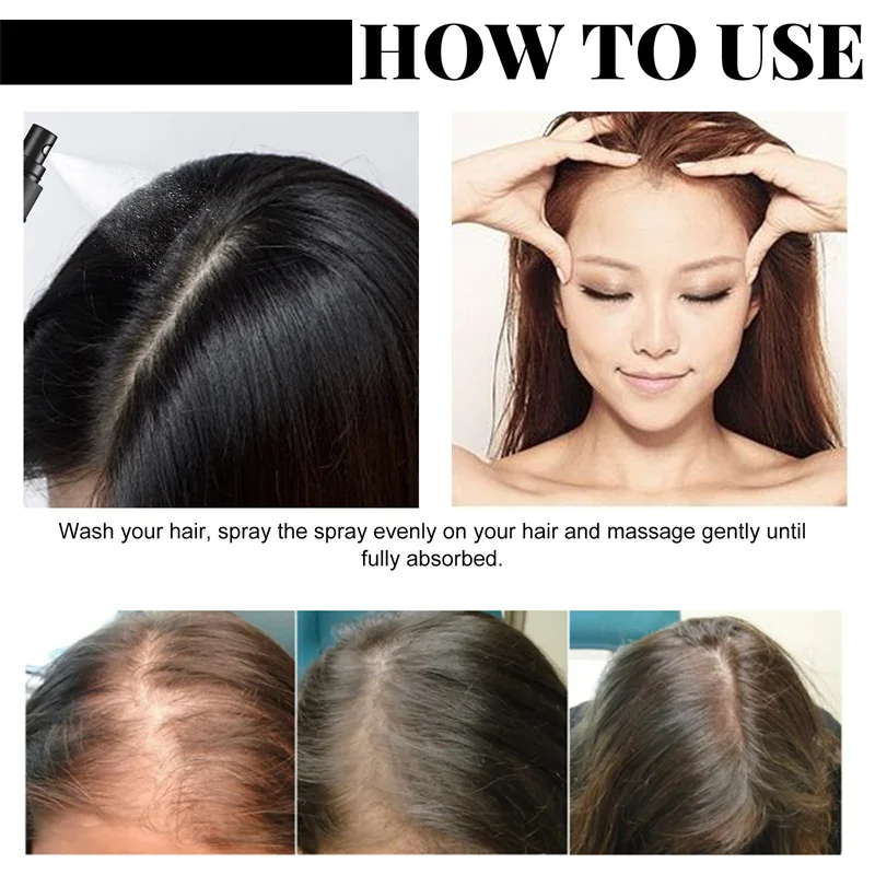 30ML Batana Oil Hair Growth Oil for Men Women Anti Hair Loss Scalp Treatment Serum 7 Day Fast Regrowth Care Growth Products
