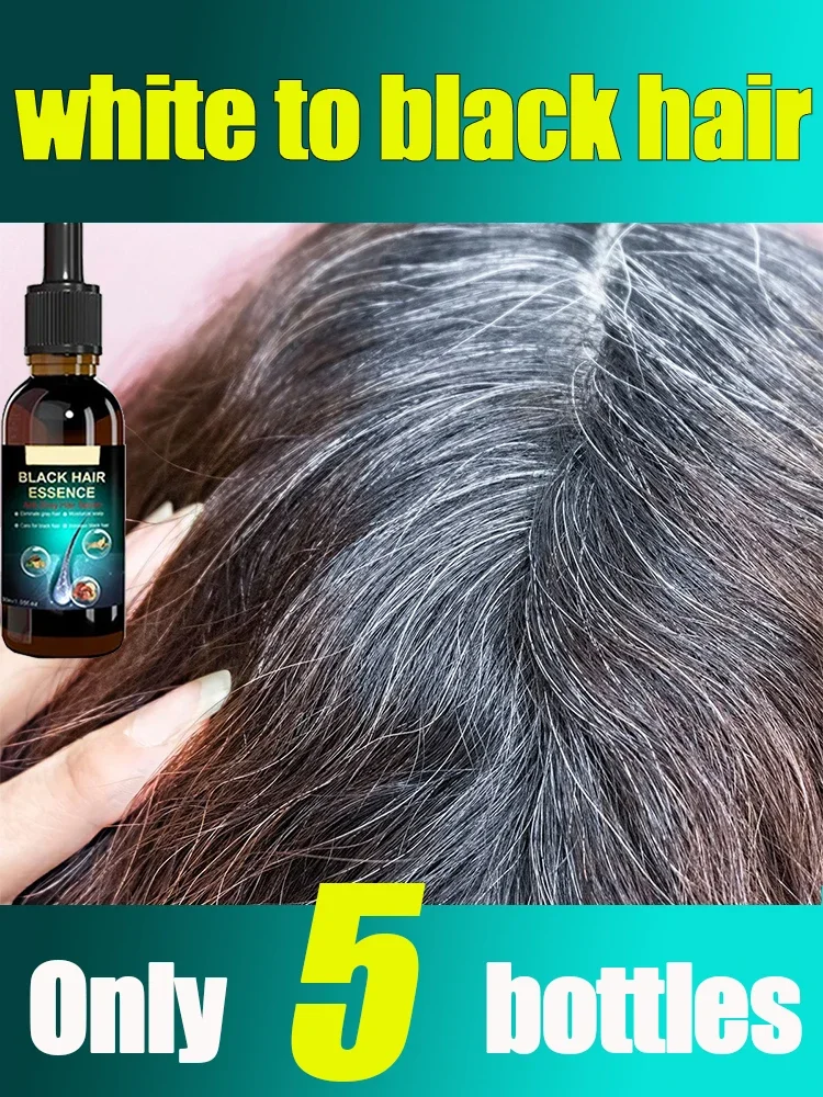 

Natural Gray White Hair Treatment Serum Liquid White To Black Natural Color Repair Nourish Anti Loss Hair Care for Men Women