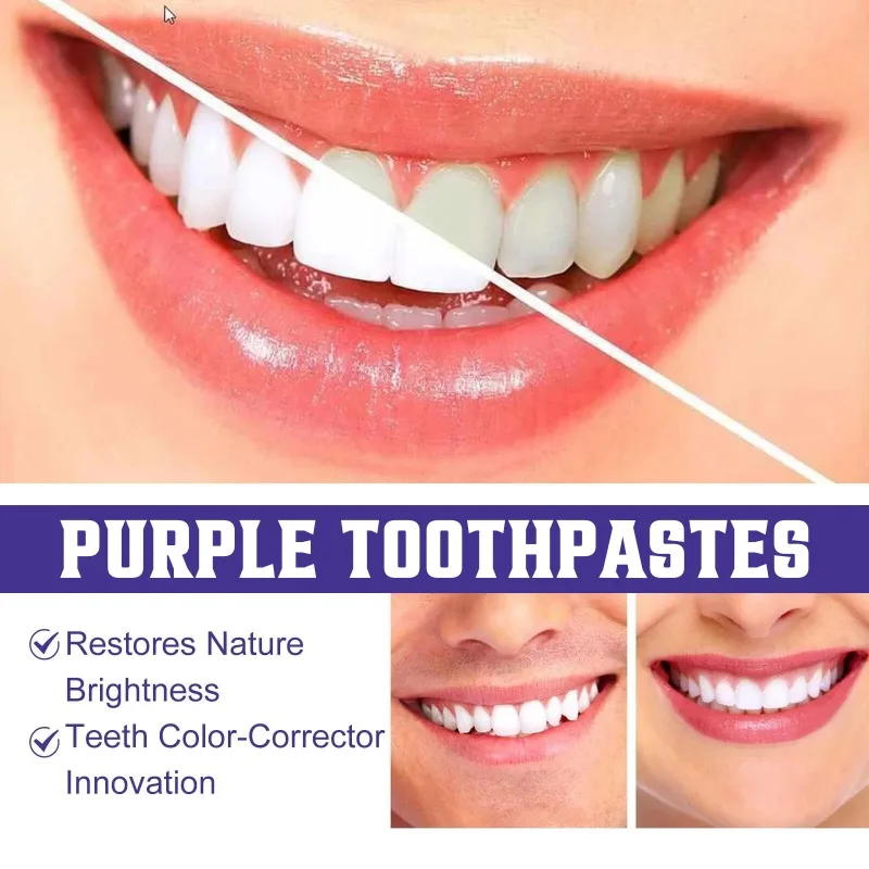 Smilekit V34 Purple Toothpaste Color Corrector Teeth Cleans Oral Cavity Keep Refreshing Yellow Stain Reduction Whitening Product
