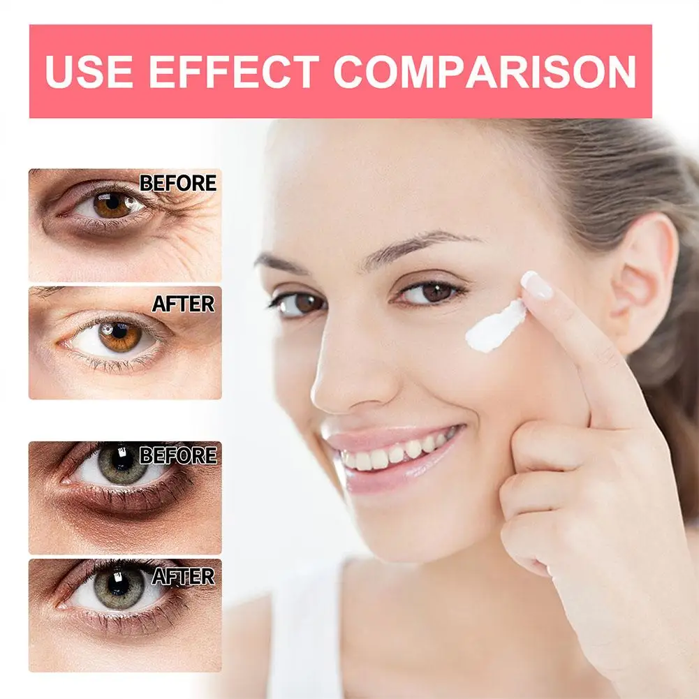 3PCS Retinol Eye Cream Stick Anti-aging Anti Wrinkle Firming Moisturizing Puffiness Black And Circles Deep Lightening