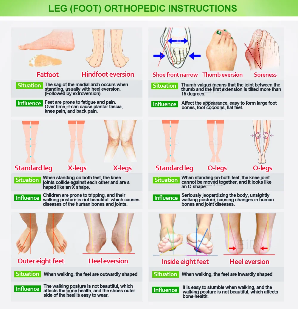 Kinder Kind Professionelle arch support Orthesen einlegesohlen für Kid Flache Füße Cubitus Varus XO bein plantillas Pad für schuhe Einsätze – Detail 34
