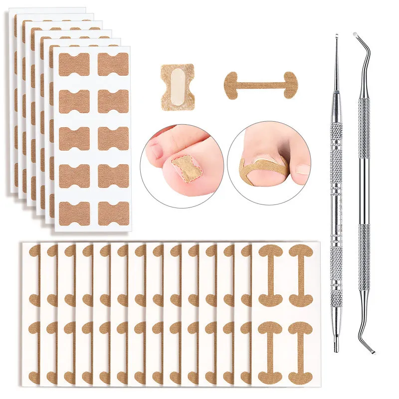 

Ingrown Toenail Corrector Patch Set Nail Correction Care Stickers Paronychia Treatment Recover Corrector Foot Care Pedicure Tool