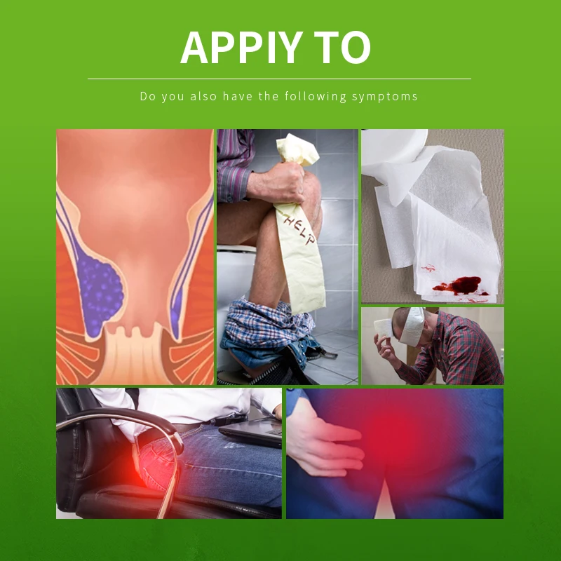 Hemorrhoids Removal Cream Internal External Hemorrhoid Treatment Herbal Ointment Anal Fissure