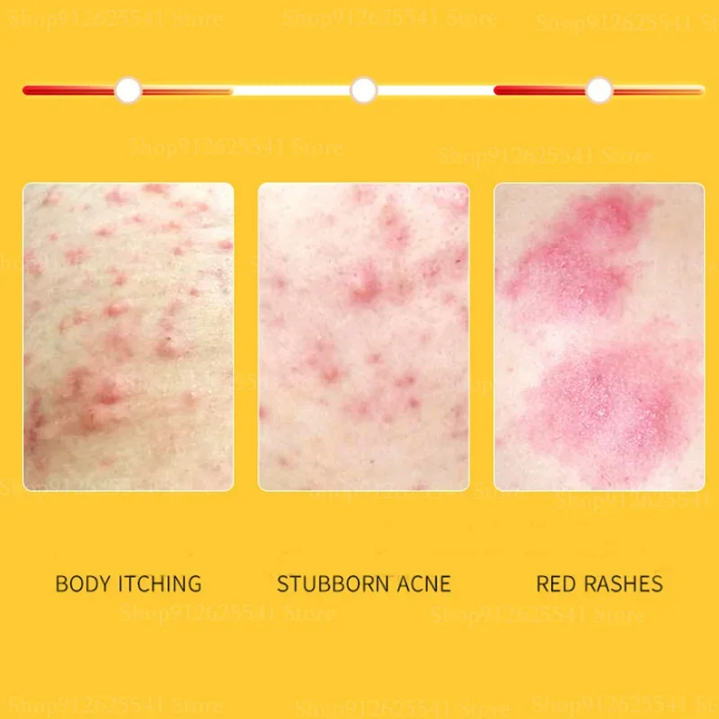 Whitening Body Cream Sulfur Ointment Scabies Mites Fat Bath Sulphur Body Wash Lotion for Itching and Sterilization 400ml body lotion body wash