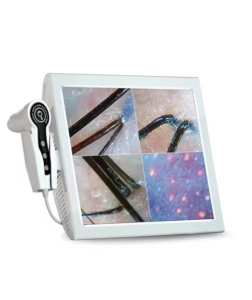 2025HD Digital Skin Analyzer Professional Hair Scalp Camera Detector Hair Follicle Oil Moisture Test Device 15inch 3