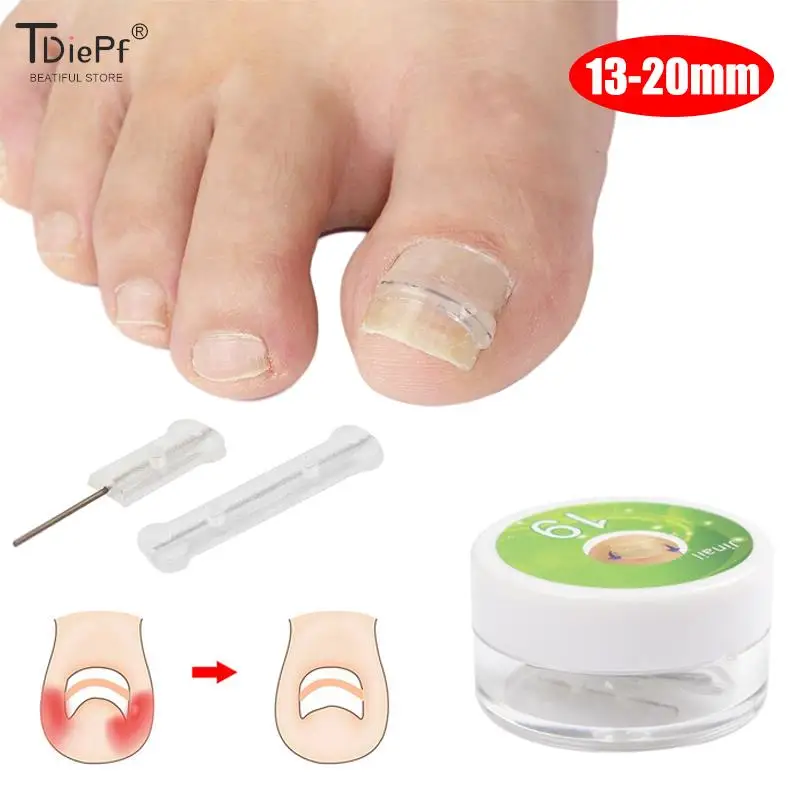 10pc/box Ingrown Toenail Correction Tool Ingrown Toe Nail Treatment