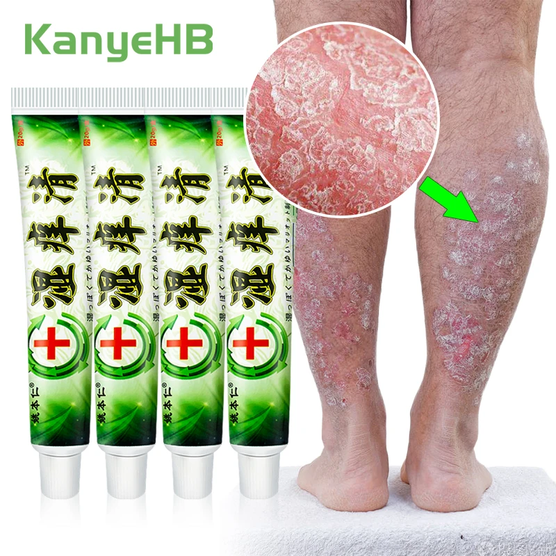 1/3/5pcs Psoriasis Ointment Psoriasis Treatment Cream Inhibit Fungi Anti itch Treat Rash Eczema