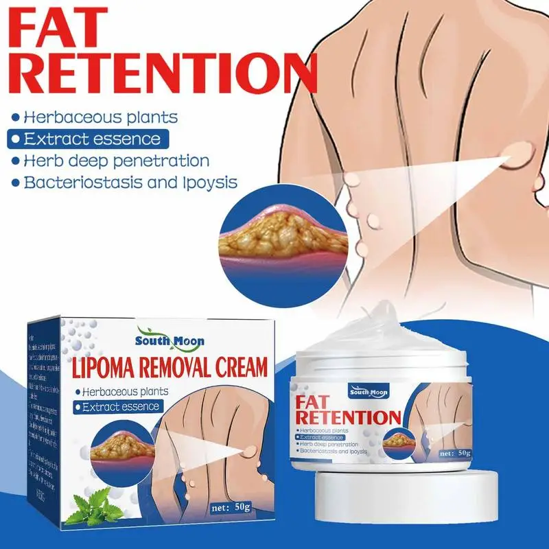 Lipoma Removal Cream The Whole Body Multiple Subcutaneous Conditioning Cream Eliminate Paste Fiber Paste Skin Care 50g