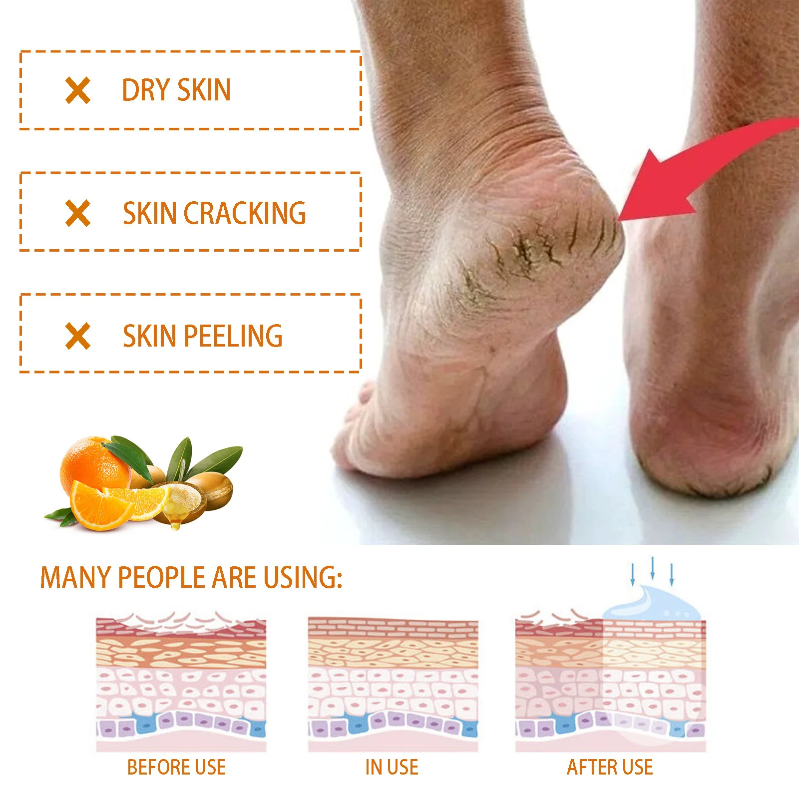 Foot Cream Anti Crack Remove Dead Skin Calluse Drying Repair Heel Chapping Smooth Nourishing Exfoliating Moisturizer foot cream