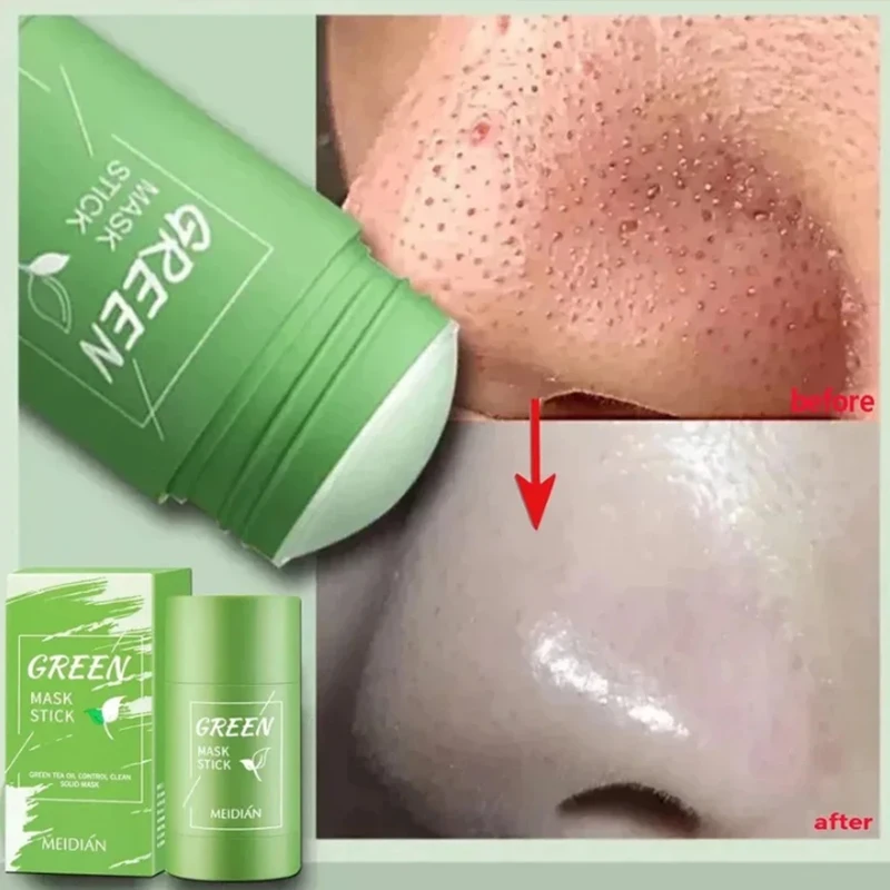 Green-Tea-Solid-Cleansing-Mask-Remove-Blackhead-Acne-Dispel-Acne ...