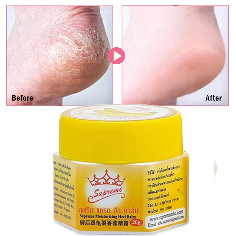

Foot Cream Anti-cracking Moisturizing Brighten Anti-drying Anti-Aging Cracked Feet Banana Peel Extract Vitamin E Foot Care 20g