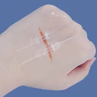 Zipper Band-aid Painless Wound Closure Device Suture-free Wound Dressing Patches Zip Suture Reducer Band Aid 1