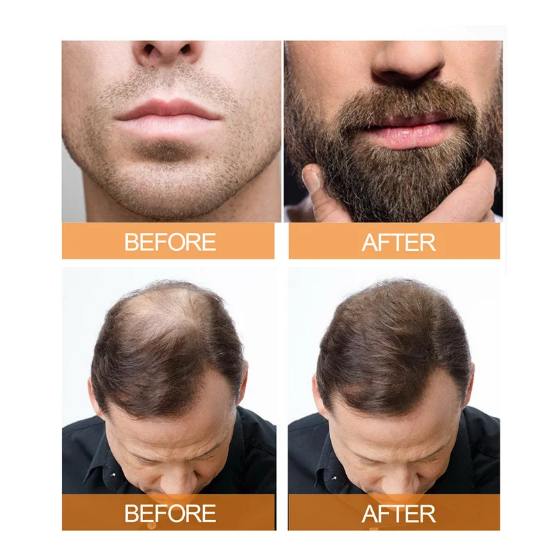 JAYSUING 100ml Hair Care Spray Mens Scalp Beard Hair Thick Care Deep Nourishment Repair Treatment Anti Loss Spray Liquid