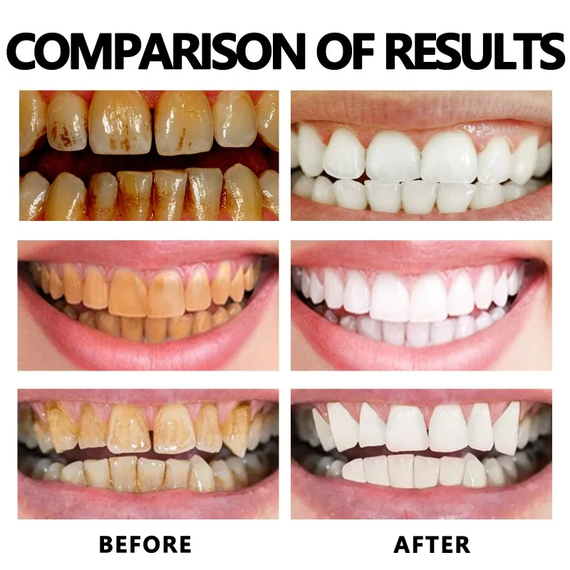 Gum Regrowth Foam Brighten Whitening Yellow Teeth Toothpaste Foam Cleaning Effective Removing Tooth Stain Oral Cleaning Product 4
