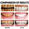 Gum Regrowth Foam Brighten Whitening Yellow Teeth Toothpaste Foam Cleaning Effective Removing Tooth Stain Oral Cleaning Product 4