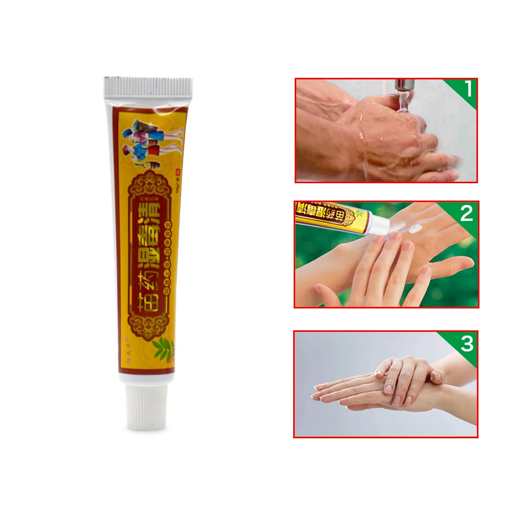 15 جرام كريم مرهم الصدفية العشبي الطبيعي الأكزيمات...