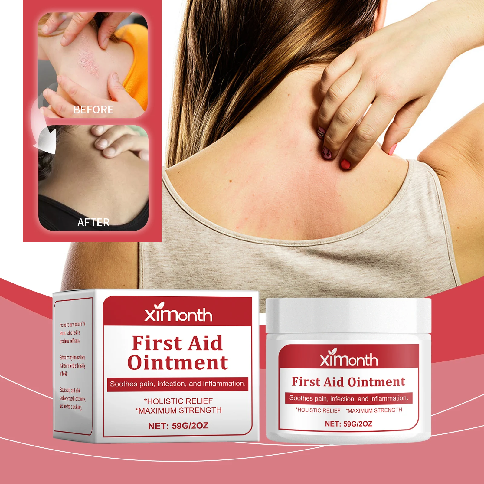 Repair Psoriasis Ointment Relieve Skin Itch Dryness Rash Desquamation Anti Fungus Treat Folliculitis Urticaria Hypersensitivity
