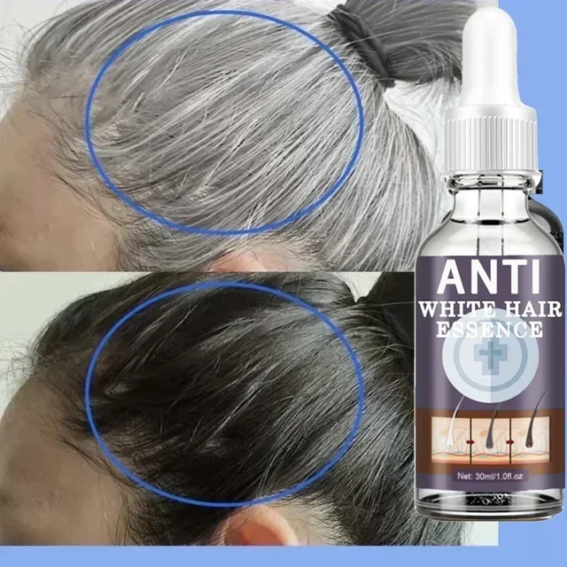 Tueur de cheveux blancs, élimine les cheveux gris et restaure la coloration naturelle des cheveux en 7 jours 1