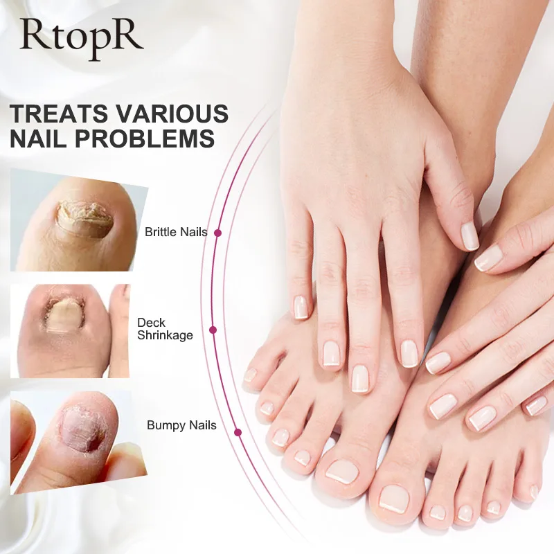 Nail Repair Serum Repair Damaged Nails Prevent Fungal Infections Treat Nail Infections Nail Care Health Beauty Ginger Extract