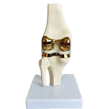 Artificial Knee Joint Model 1
