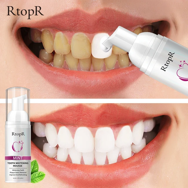 Mint Teeth Whitening Beauty, Health $ Hair Gifts For Men Gifts for women
