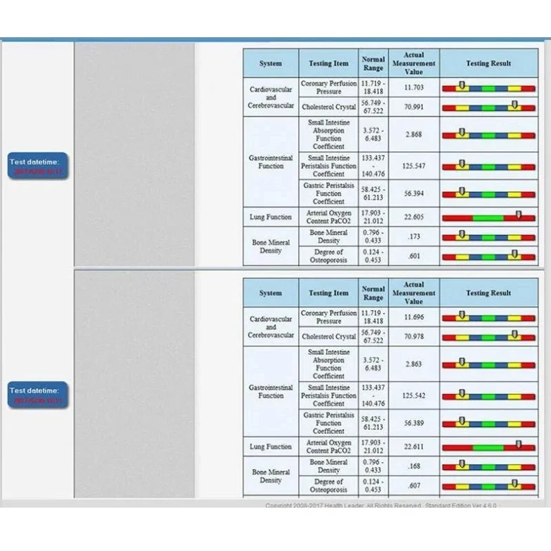 Newest QMR-998 Quantum Magnetic Resonance Analyzer Hand Touch Quantum Body Health Analyzer 2024 Version Diagnosis Test Machine