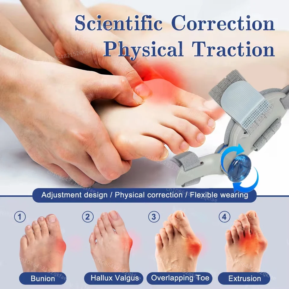 Bunion Hallux Valgu Big Valgus Rotatable Corrector Straightener Adjustable Toe Correction_voghion.com