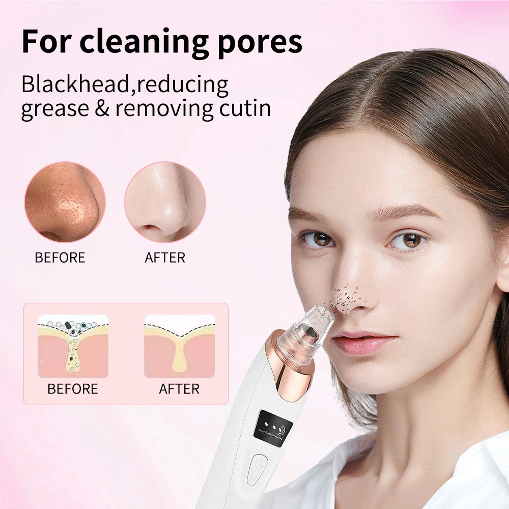 Electric Vacuum Suction Blackhead Remover Facial Pore Cleaner Comedone Spot Acne Pimple Blackhead Extractor USB Rechargeable 3