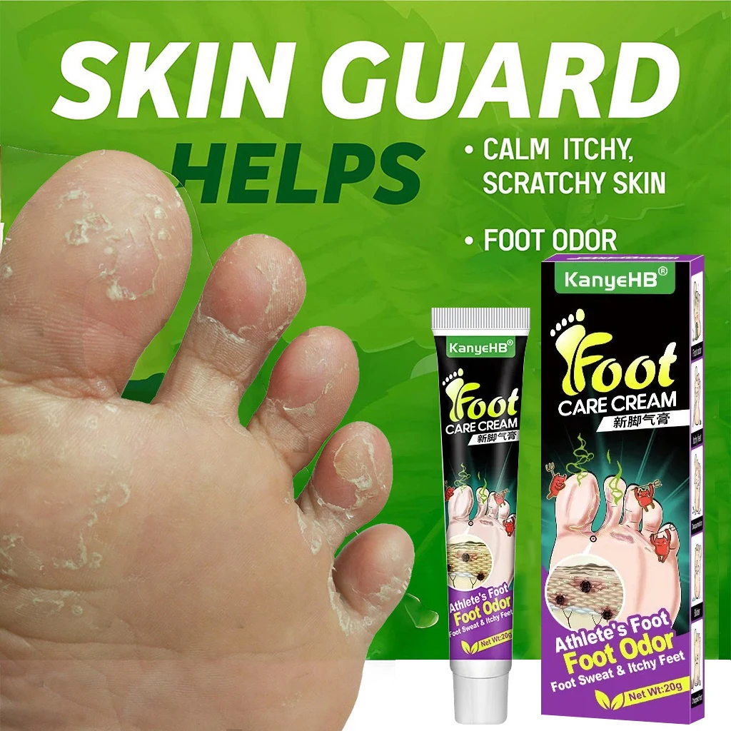 

Foot Fungus Removal Cream Anti Fungal Infection Onychomycosis Paronychia Remove Beriberi Dead Skin Repair Foot Cracked Feet Care
