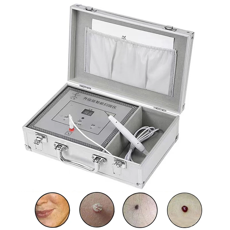 220V Electronic Spot Scanner Dead Skin Removal Beauty Device Remove Dark Mole Face Cleaner Skincare Tools Blackhead Remover