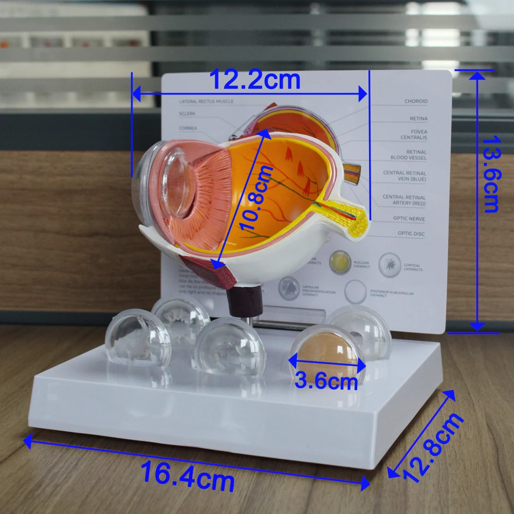 Cornea Eyeball Model Human Eye Demonstration Glaucoma Cataract Anatomy Medical Teaching Tool