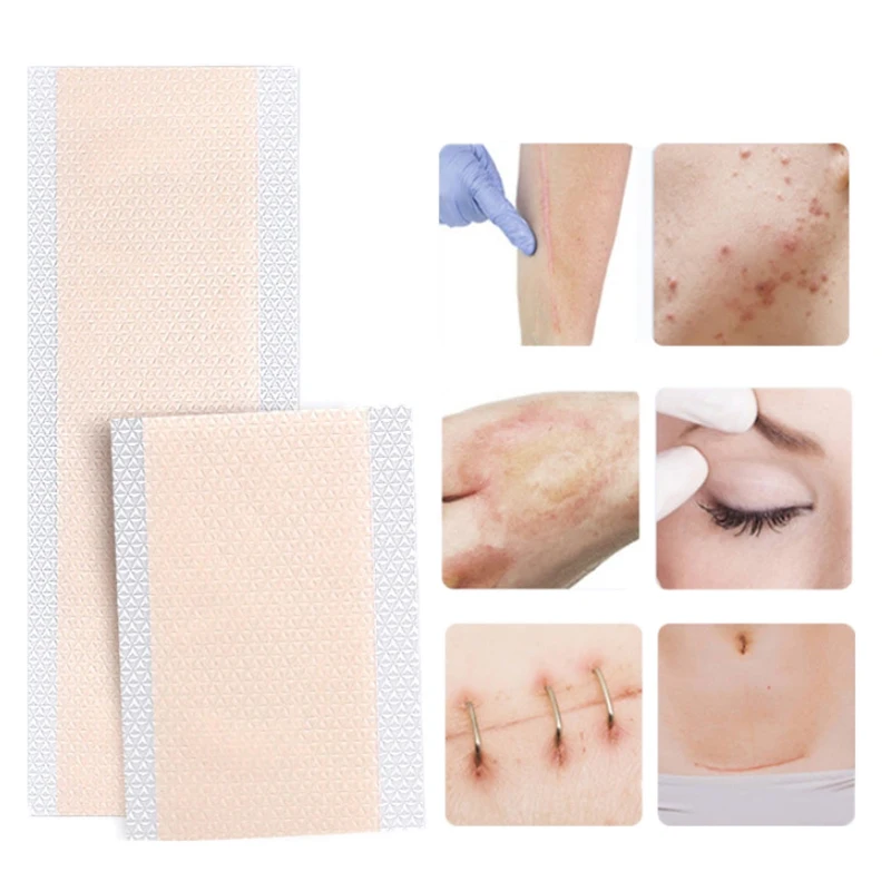 

Silicon Gel Tattoo Scar Flaw Invisible Covering Patch 15/20cm Length For Birthmark Black Nevi White Spots Waterproof Cuttable