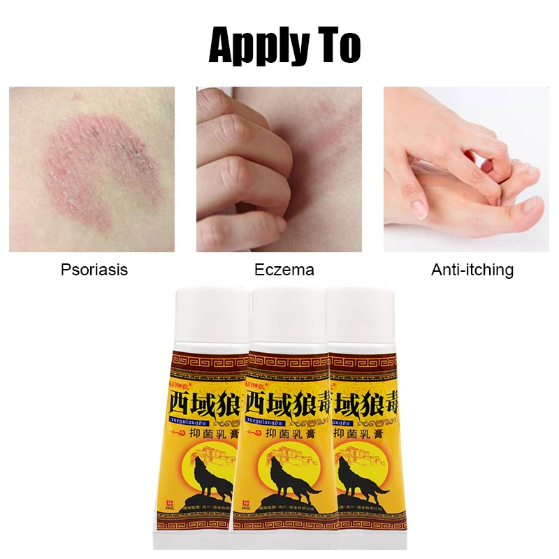 

30g Herbs Body Eczema Ointment Skin Pruritus Swelling Repair Cream Effective Dermatitis Psoriasis Antipruritic Care Dressing