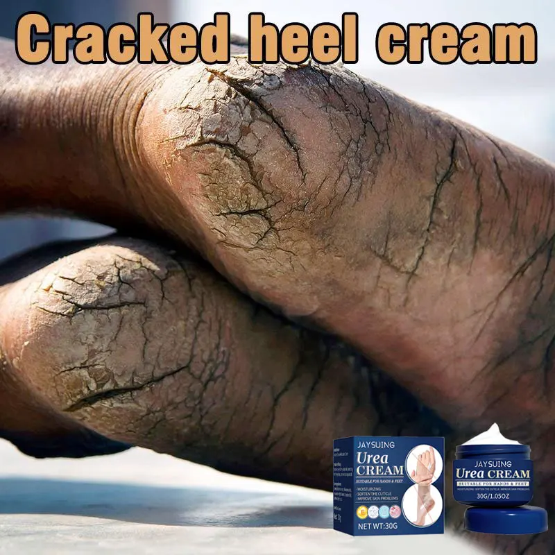 75G Anti-Drying Crack Foot Cream Stick Feet Callus Remover Skin Care Cream  Repair Foot Mask Dead Skin Remover Organic Spa Oil - AliExpress