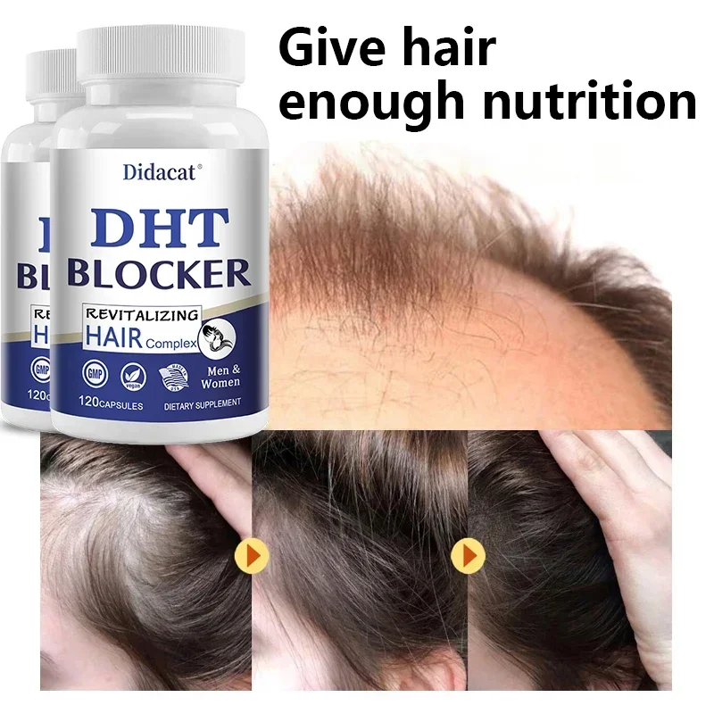 Reduces Prostate Inflammation DHT Blockers Promote Hair Growth,Hair Loss,Thinning Hair in Men-Saw Palmetto Prostate Supplement - Image 4