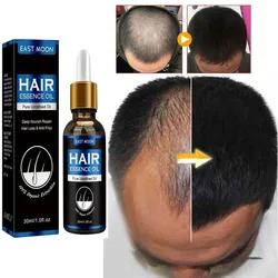 Growth Hair Oil Rapid Effective Repair Baldness Hair Follicle Hereditary Hair Loss Postpartum Hair Loss Seborrheic Hair Care New