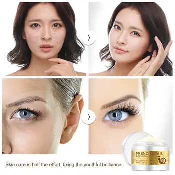 프랑스 달팽이 페이스 크림. 주름 안티 에이징 콜라겐 크림, 여드름 크림
