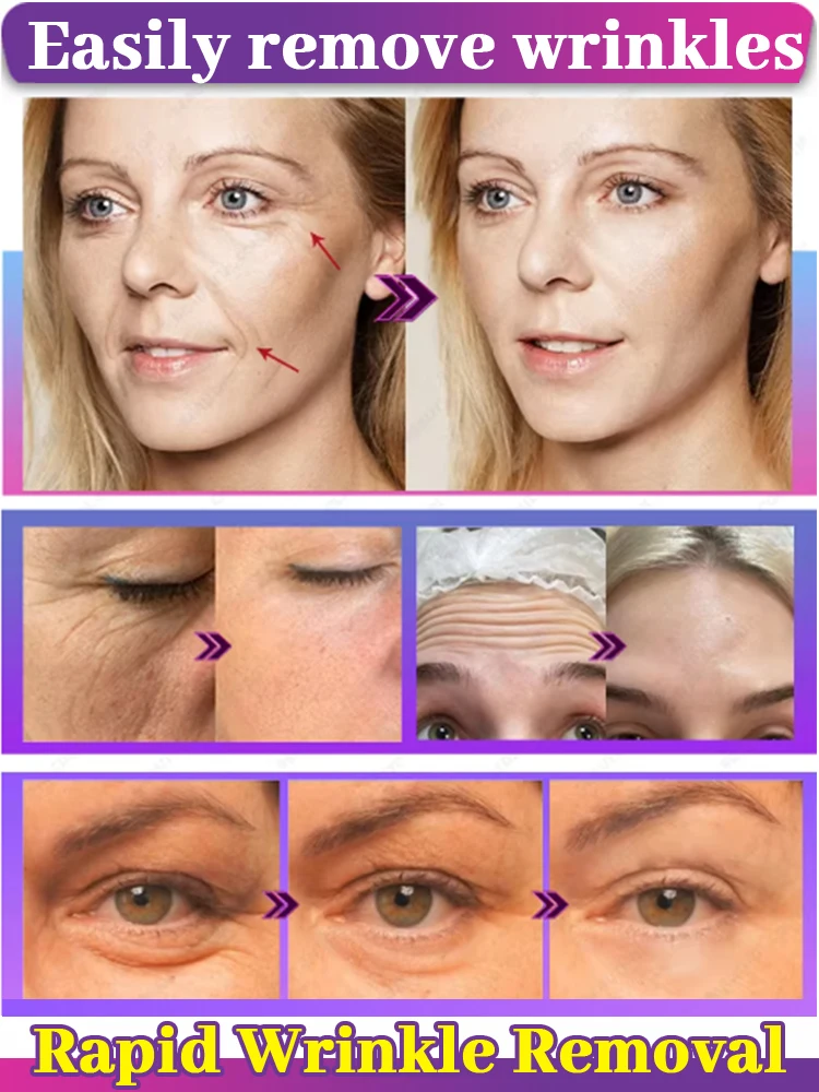 Wrinkles disappear Become beautiful now 2